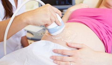 siêu âm dị tật thai nhi